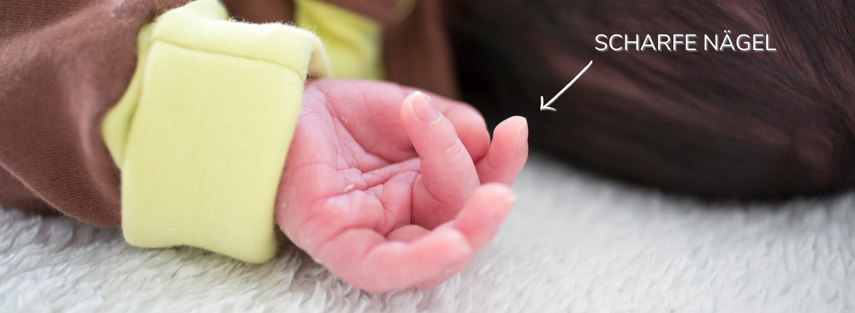Neugeborene haben sehr lange FIngernägel