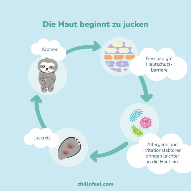 1. Hilfe! Pollenflug und Ekzeme auf der Kinderhaut