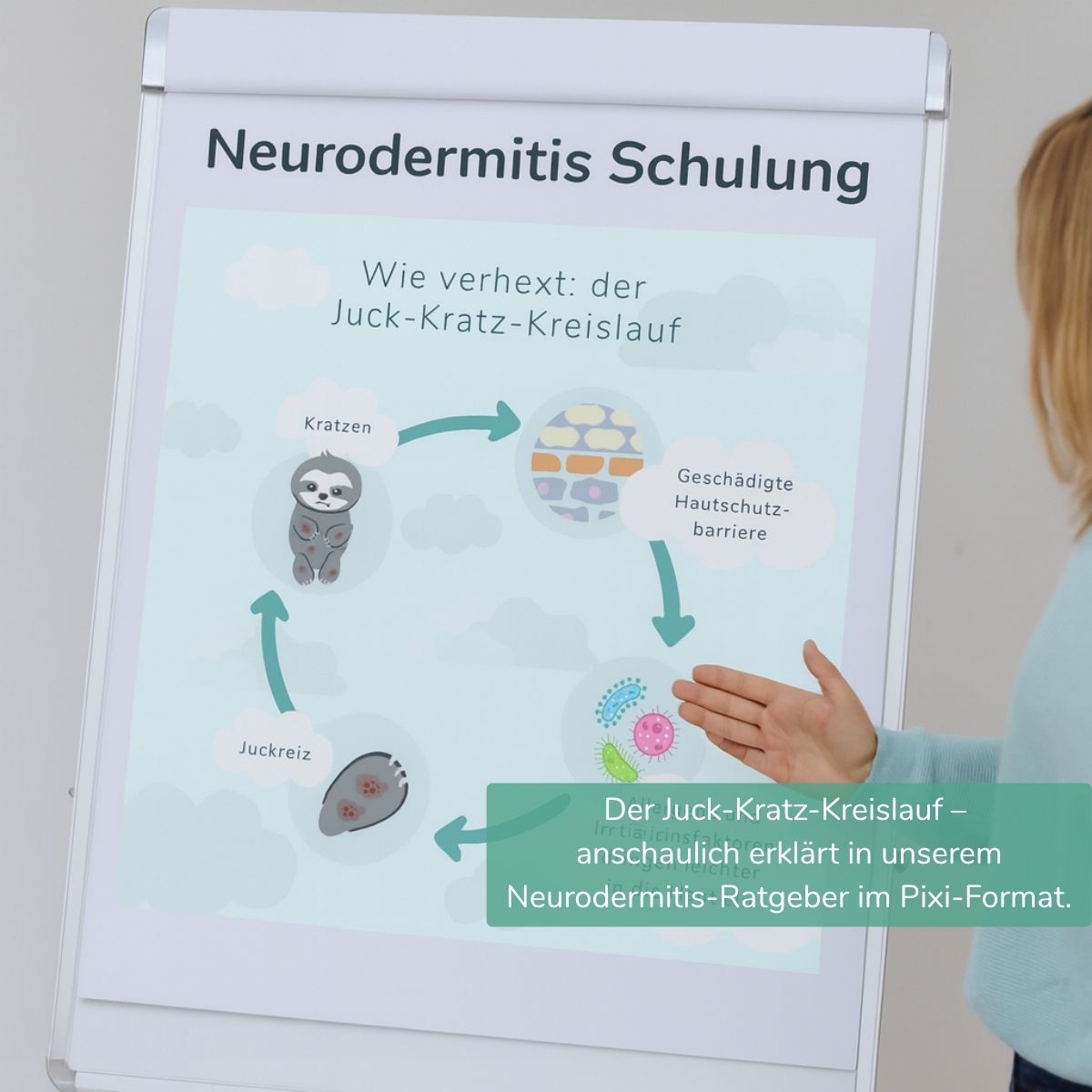 Flipchart mit Juck-Kratz-Kreislauf, vorgestellt in einer Neurodermitis Schulung